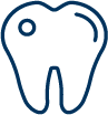 Composite Fillings