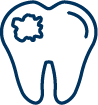 Amalgam Fillings