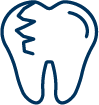 Pulpotomy